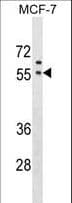 Polyclonal Rabbit anti-Human GORASP1 / GRASP65 Antibody (aa91-119, WB)