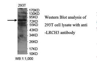 LRCH3 Antibody (aa285-455)