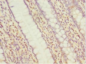 Polyclonal Rabbit anti-Human MYLK3 Antibody (IHC)