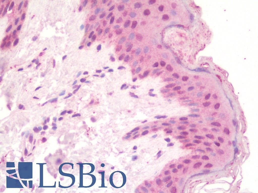IHC-plus™ TLX1 / HOX11 Antibody