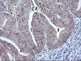 Monoclonal Mouse anti-Human MAP2K3 / MEK3 / MKK3 Antibody (clone OTI6C6, IHC, IF, WB)