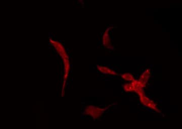 KCNK7 / K2p7.1 Antibody