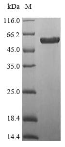 Mouse WNT7B Protein (Recombinant 10His-SUMO, N-terminus + Myc, C-terminus)