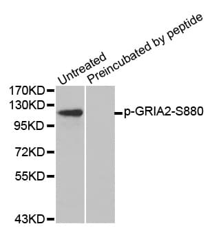 GRIA2 / GLUR2 Antibody (phospho-Ser880)