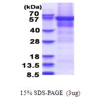 Human CPEB1 / CPEB Protein (Recombinant His)