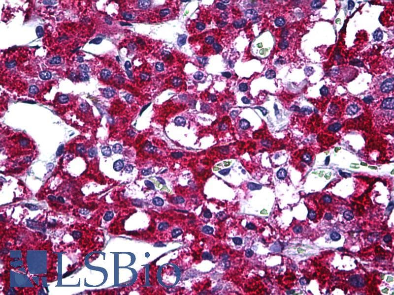 IHC-plus™ PIM1 / Pim-1 Antibody (clone 2C9)