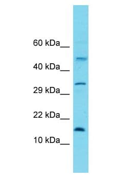 MRPL30 Antibody (aa112-161)