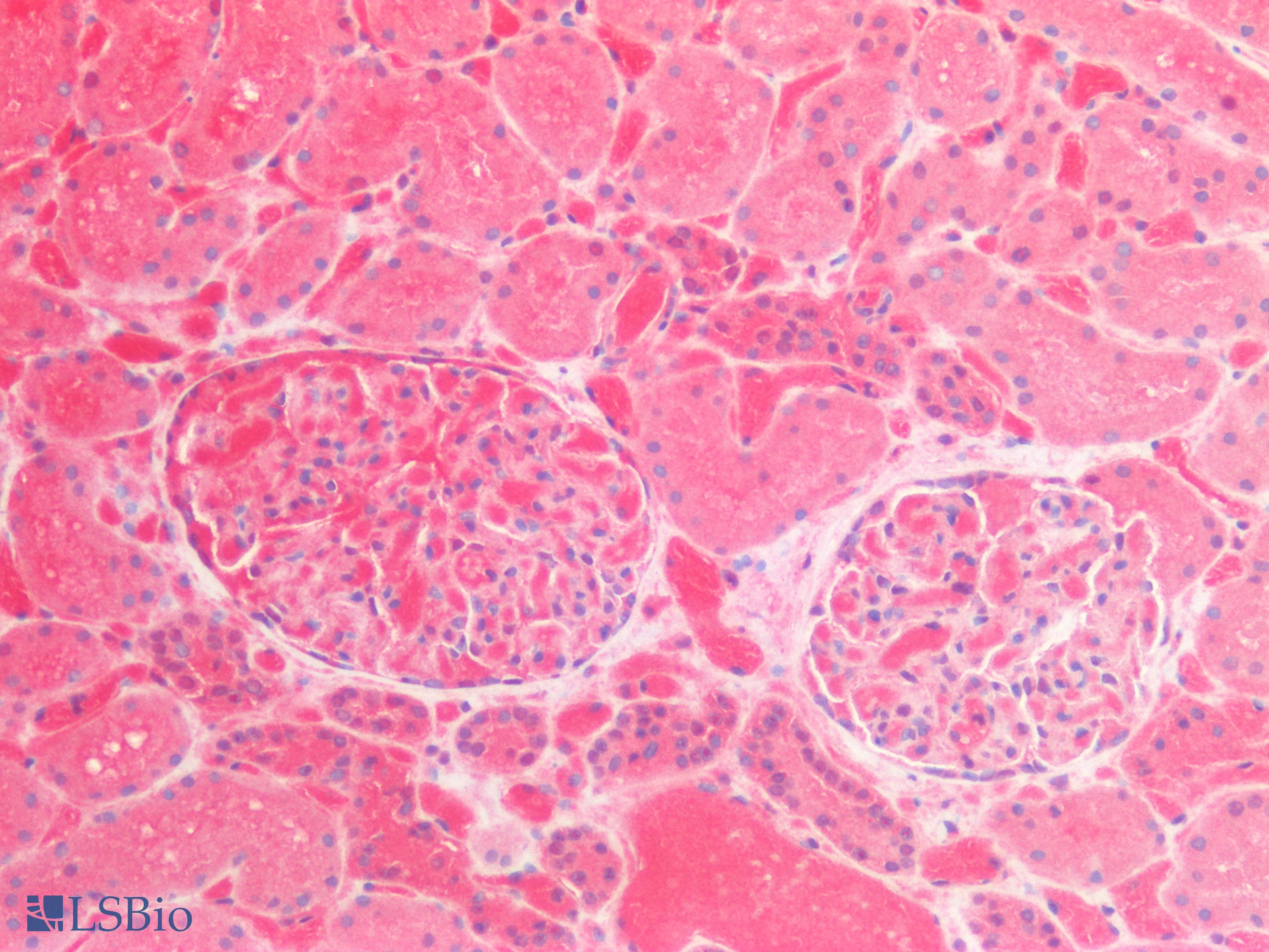 PathPlus™ Polyclonal Rabbit anti-Human Acetyl-CoA Carboxylase / ACC Antibody (N-Terminus, IHC, WB)