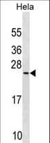 PRELID1 Antibody (aa27-54)