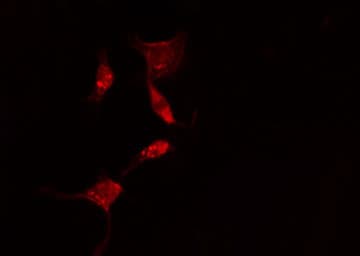 CCT5 / TCP1 Epsilon Antibody