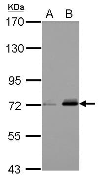 URP2 / FERMT3 Antibody
