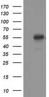 TP53 / p53 Antibody (clone OTI5B2)