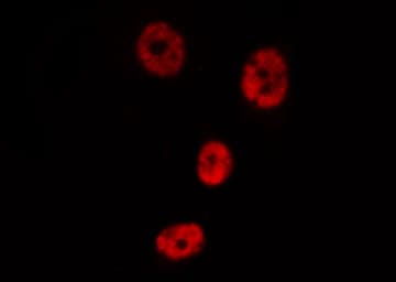 Polyclonal Rabbit anti-Human RELA / NFKB p65 Antibody (phospho-Thr435, IHC, IF, WB)
