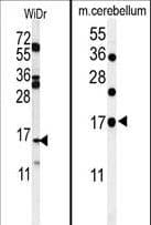 TPPP3 Antibody (aa117-146)
