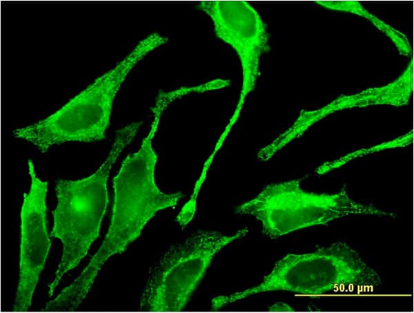IHC-plus™ GALNT1 Antibody (clone 3C10)