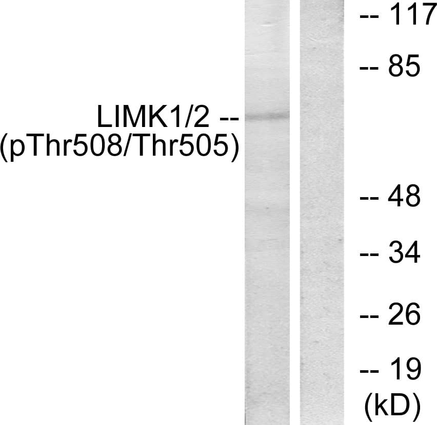 LIMK1 / LIMK Antibody (phospho-Thr508)