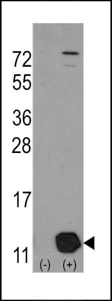 IHC-plus™ PHPT1 Antibody (aa88-117)