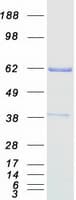 Human CHAF1B / CAF1 Protein (Recombinant Myc-DDK (Flag))