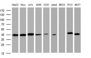 TBCC Antibody (clone OTI1B2)