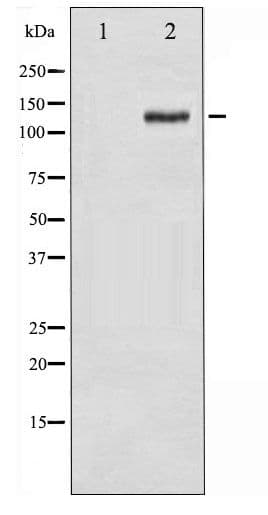Polyclonal Rabbit anti-Human FAK / Focal Adhesion Kinase Antibody (phospho-Tyr925, WB)