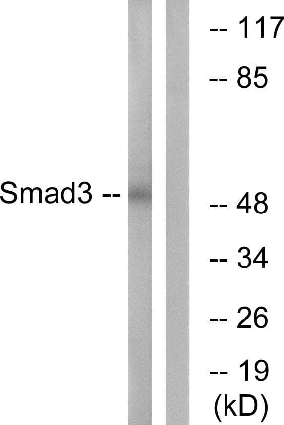 Polyclonal Rabbit anti-Human SMAD3 Antibody (p179, WB)