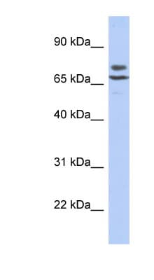POMGNT2 / GTDC2 Antibody (N-Terminus)