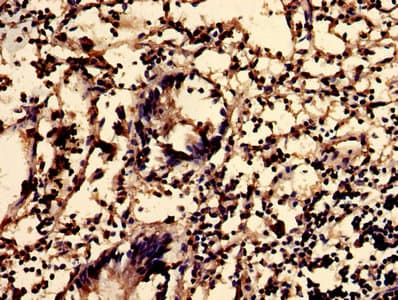 Polyclonal Rabbit anti-Human SMS2 / SGMS2 Antibody