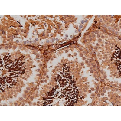 MAPT / Tau Antibody (phospho-Ser262)