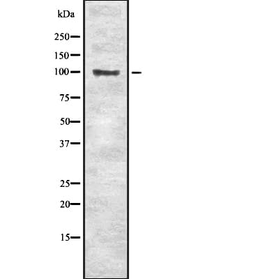 SLC4A1 / Band 3 / AE1 Antibody (aa347-367)