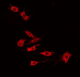 RCS / ARPP-21 Antibody