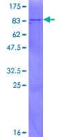 Human PARS2 Protein (Recombinant GST)
