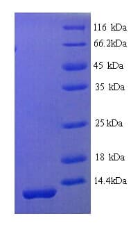 Mouse SPINK1 Protein (Recombinant His)