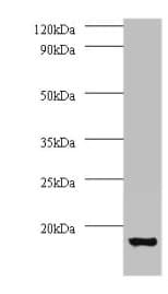 ATP6V1G1 / ATP6J Antibody