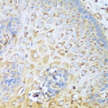 Polyclonal Rabbit anti-Human MYH9 Antibody (IHC, WB)