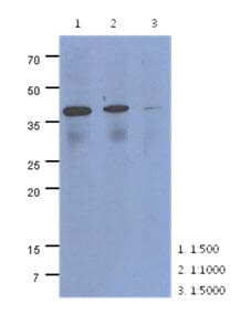 Monoclonal Mouse anti-Human CRLF2 / TSLPR Antibody (clone AT4E7, WB)