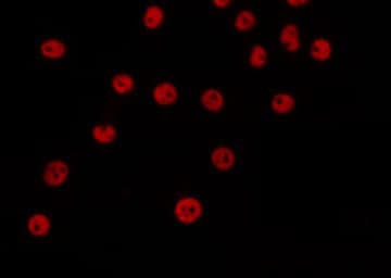 SENP1 Antibody