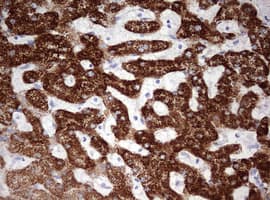 OTC Antibody (aa33-354, clone OTI5A7)