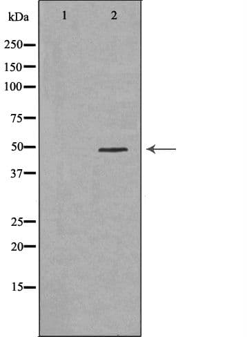 Polyclonal Rabbit anti-Human TNFRSF1B / TNFR2 Antibody (IHC, IF, WB)