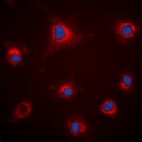 FBN1 / Fibrillin 1 Antibody (C-Terminus)