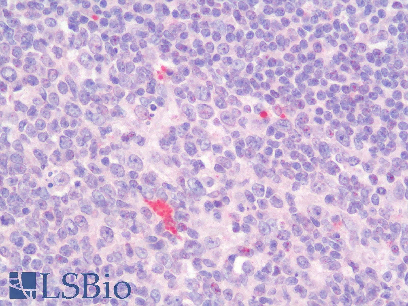 IHC-plus™ Polyclonal Rabbit anti-Human LAG3 Antibody (IHC)