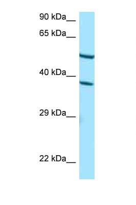 CYP4F2 Antibody (aa288-337)