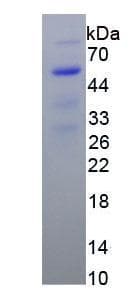 Gb:x12597 High Mobility Group Protein Hmg1 (HUMAN); (Recombinant)