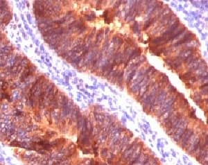 EMA / MUC1 Antibody (clone MUC1/955)