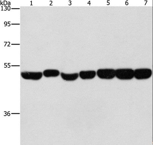 PathPlus™ ENO1 / Alpha Enolase Antibody