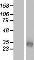 KCNK7 / K2p7.1 Protein (Over-Expression Lysate Myc-DDK (Flag))