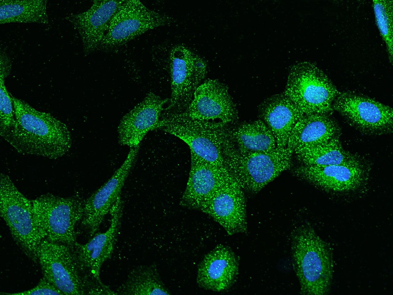 Polyclonal Rabbit anti-Human ZW10 Antibody (IF, WB)