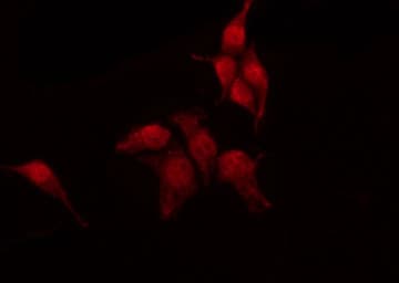 HSPA8 / HSC70 Antibody