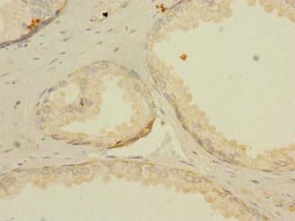 Polyclonal Rabbit anti-Human LNX2 Antibody