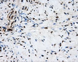 Monoclonal Mouse anti-Human LOX / Lysyl Oxidase Antibody (clone OTI6B11, IHC, IF, WB)
