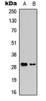 GZMK / Granzyme K Antibody (Internal)